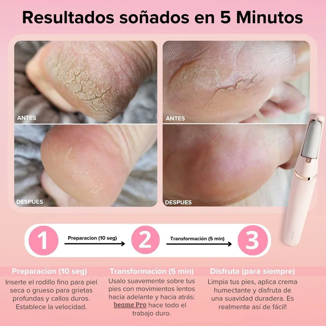Kit Beame - Elimina piel seca y callos en 5 minutos